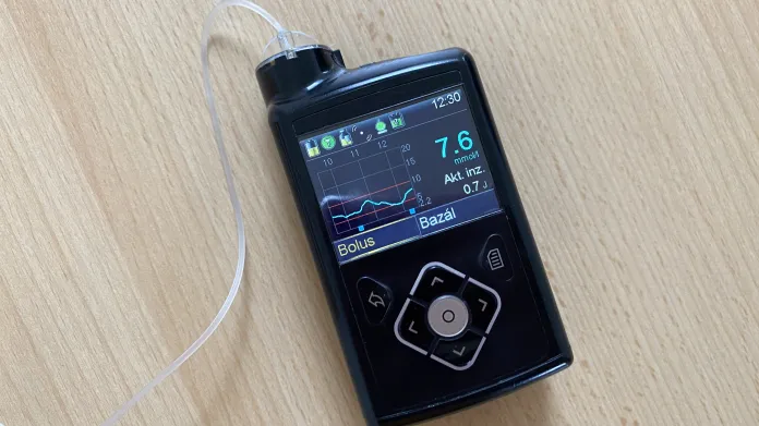 Inzulinová pumpa zobrazující senzorem naměřené hodnoty glykemie
