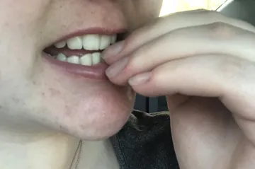 Konec okusování nehtů? Němečtí psychologové představili techniku, která zlozvyku zbavuje