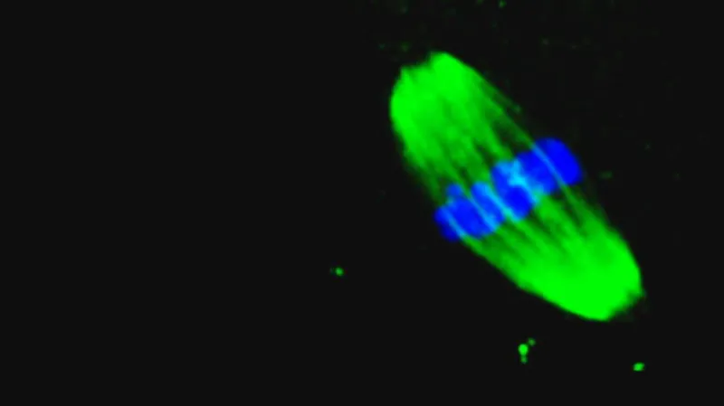 Výzkum Downova syndromu