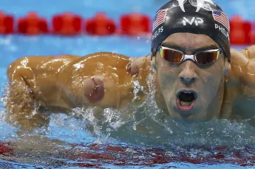 Záhadné kruhy a fleky na tělech olympioniků? V Riu zkoušejí baňkování