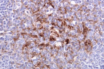 Ve Francii zakázali výzkum prionů. Vyšetřují případy vědkyň, které se mohly nakazit smrtící nemocí 