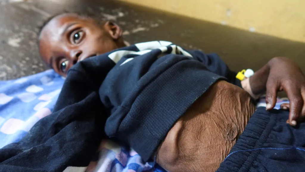 Hladomor zasáhl v Súdánu i malé děti