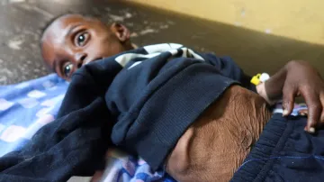 Hladomor zasáhl v Súdánu i malé děti