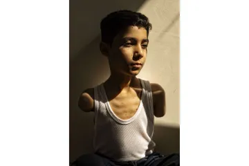 Vítězným záběrem World Press Photo je snímek palestinského hocha bez rukou