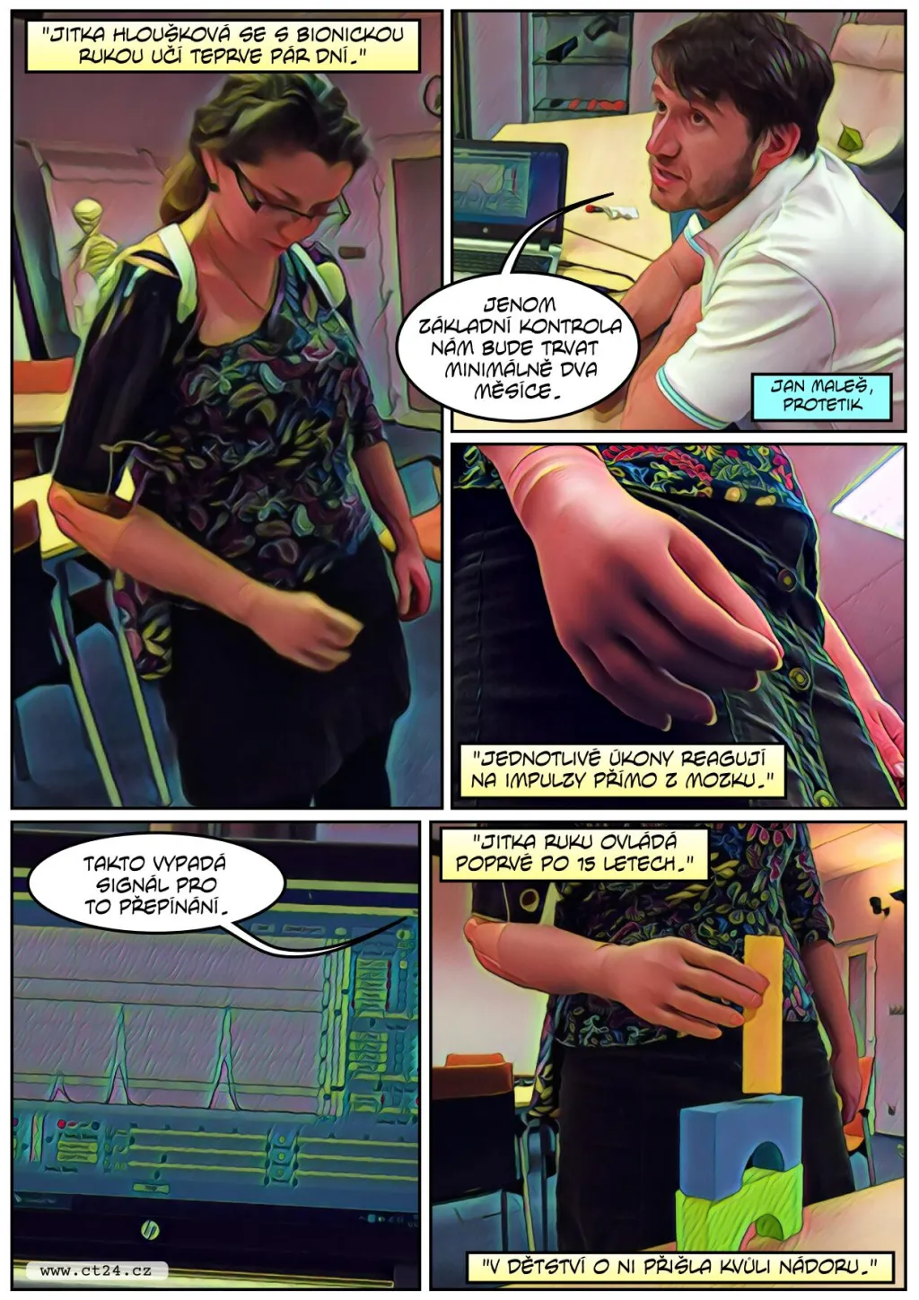 Drahé robotické protézy místo končetin. Nově mají nárok na jejich proplacení i děti s vrozenou vadou