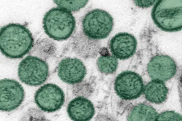 Není hantavirus jako hantavirus. Některé druhy jsou i v tuzemsku