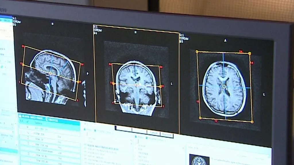 Neurologické vyšetření
