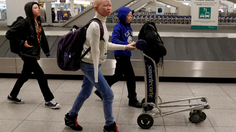 Trojice mladých Tanzánců přijela do USA za léčbou i bezpečím