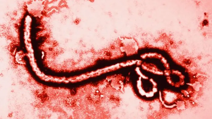 USA hlásí první případ nákazy ebolou