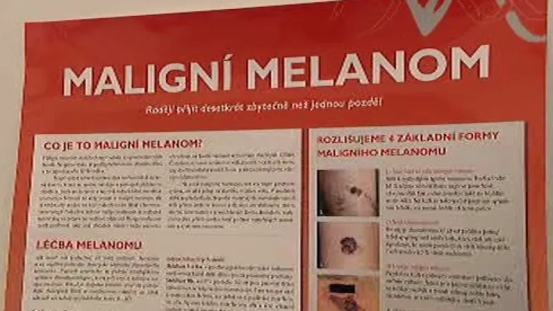 Maligní melanom