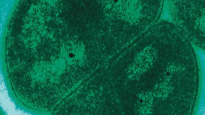 Bakterie Deinococcus radiodurans pod mikroskopem
