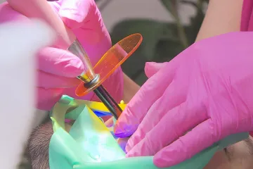 Plomby z amalgámu nahradí bílé, za něž se bude připlácet i u zubařů, kteří mají smlouvu s pojišťovnou