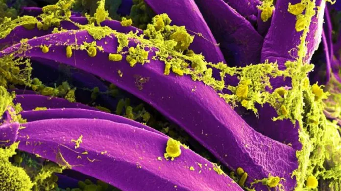 Snímky morové bakterie Yersinia pestis pod elektronovým mikroskopem