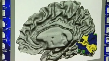 Centra paměti v mozku