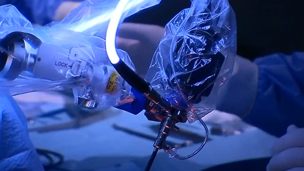 3D endoskop ve FN Ostrava