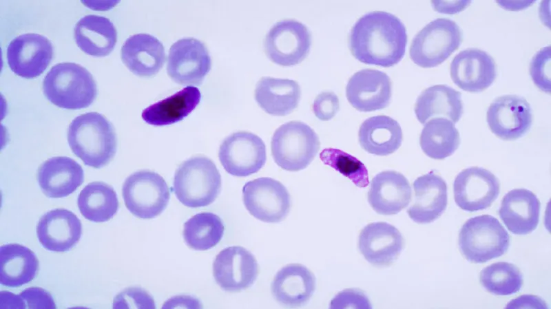 Plasmodium falciparum, původce malárie