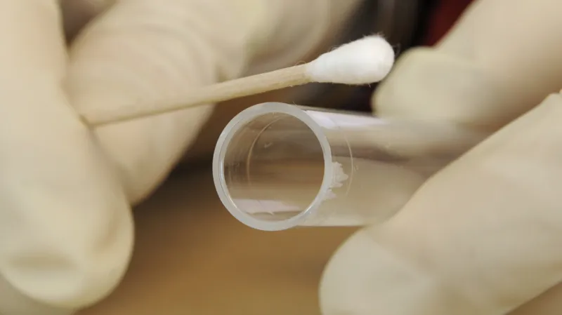 Nástroje pro odebírání vzorku DNA