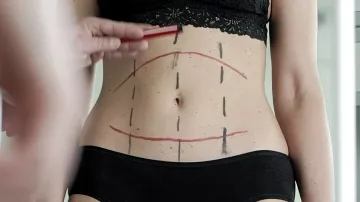 Reportéři ČT: Neestetická chirurgie