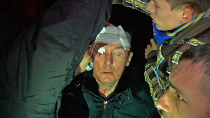 Zraněný exministr Jurij Lucenko