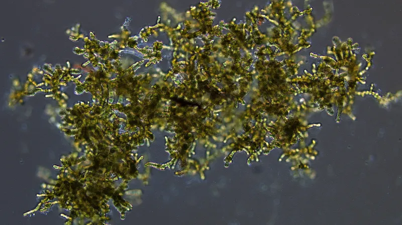 Sinice zodpovědná za smrt orlů pod mikroskopem