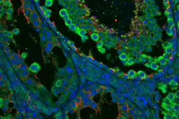 Pozor na cukrovku, ovlivňuje rozmnožování savců. Včetně člověka, popsal český výzkum