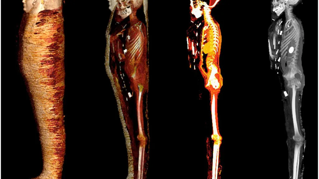 CT sken mumie „zlatého chlapce“