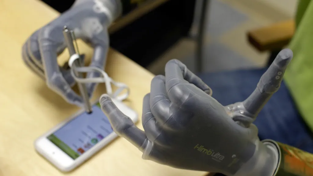 Bionické protézy Jasona Kogera