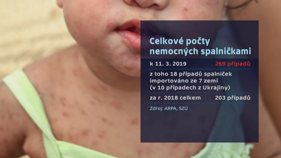 Počty nemocných spalničkami