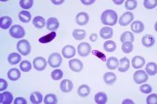 Malárie zmutovala a začala unikat testům. WHO doporučuje bedlivější dohled
