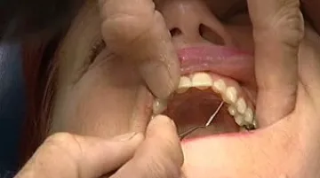 Zubní prohlídka