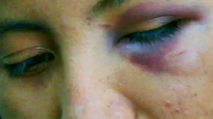 Oběť domácího násilí