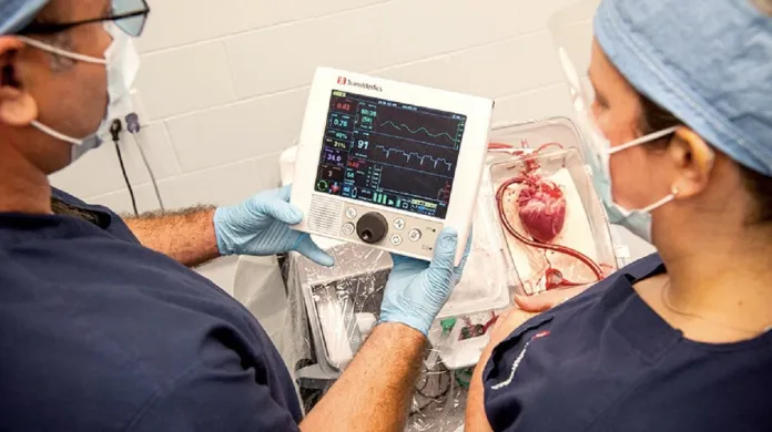 Kontrola parametrů a kvality srdce před transplantací pacientovi