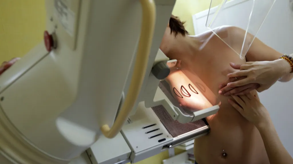 Ilustrační snímek – mamografické vyšetření