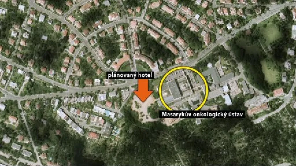 Masarykův onkologický ústav ubytuje pacienty v hotelu