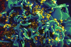 Hongkongští vědci tvrdí, že jsou na cestě k léčení AIDS