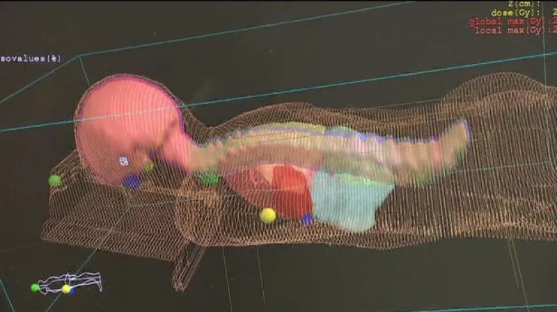 Malého Brita čeká v ČR pětitýdenní léčba protony